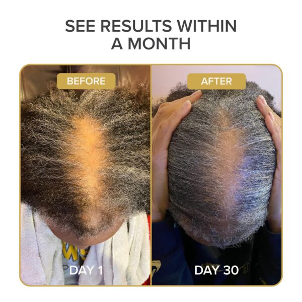 Suplemento para cabello grueso y fuerte Shedavi