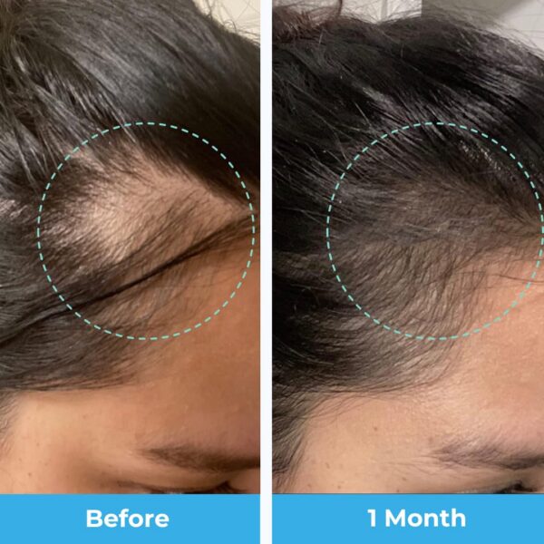 Suplemento para cabello postparto Baby Blues