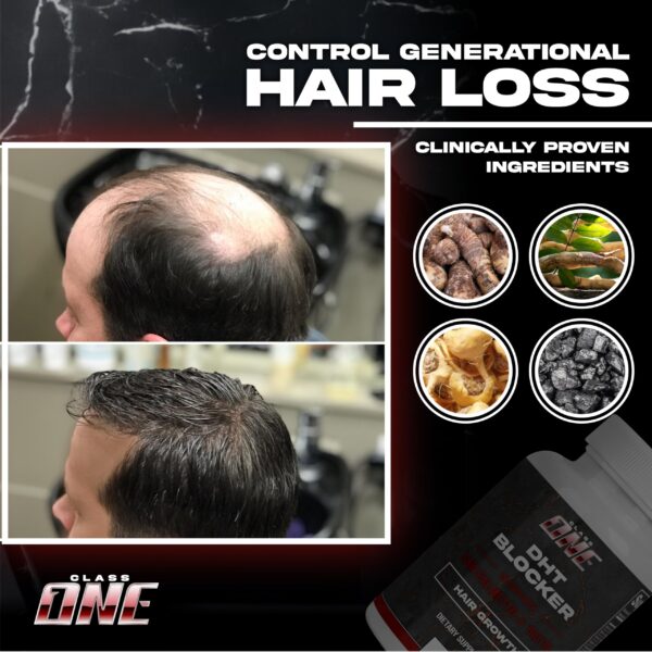 Suplemento-class-one-cabello-saludable