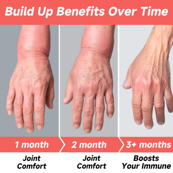 Version 1.0.0 Cápsulas suplemento RindTi para apoyo renal y salud articular