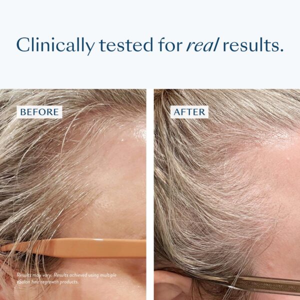 Vitaminas C y E en gominolas para folículo capilar saludable