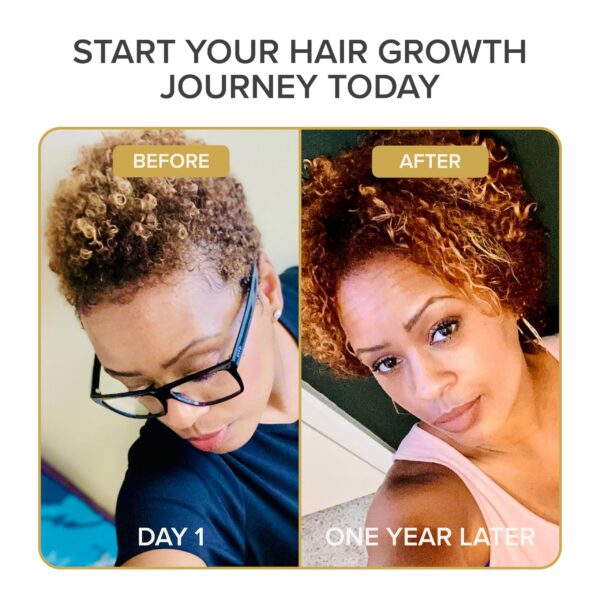 Vitaminas capilares Shedavi 60 cápsulas