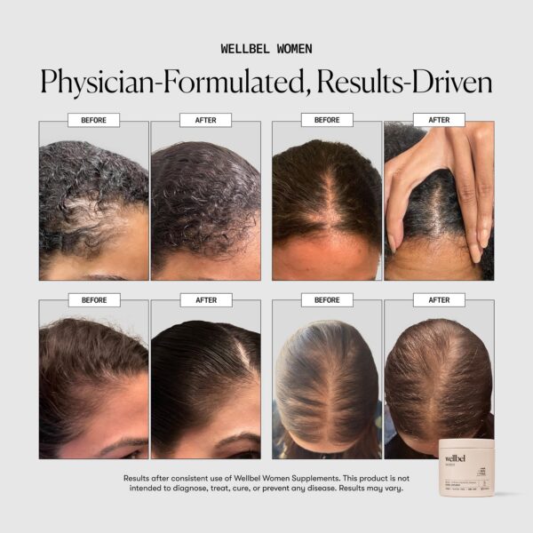 Detalle de cápsulas Wellbel