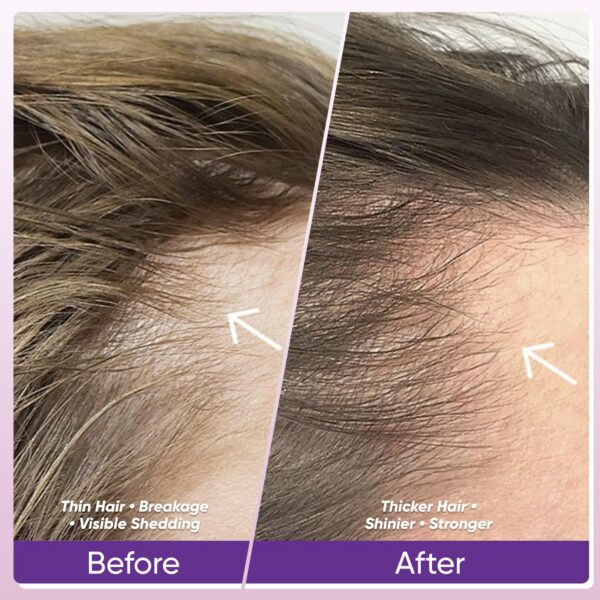 Tabletas/cápsulas WGYPEU cabello