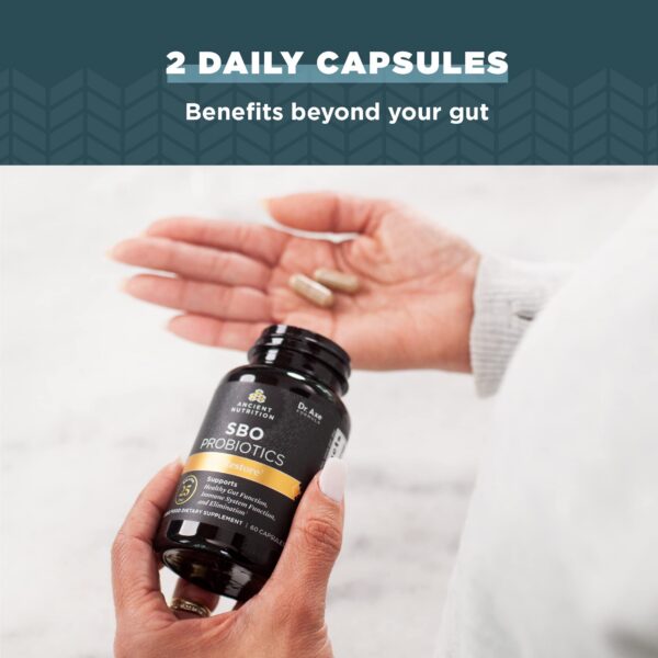 25 mil millones de UFC por porción