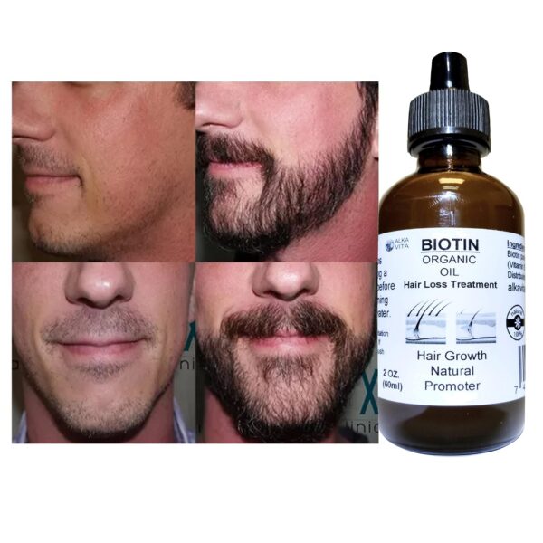 Aceite natural biotina y sílice para cabello saludable