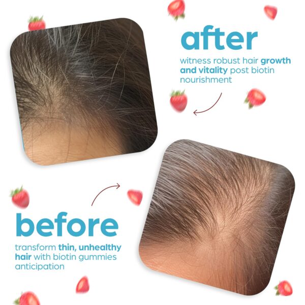 Gomitas de biotina sin gluten ni gelatina