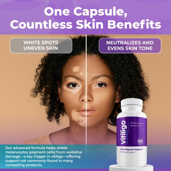 Cierre del frasco AURA VITAMINS