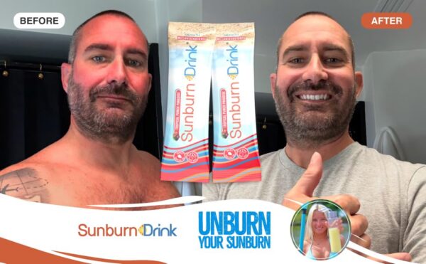 bebida sunburn caja 20 paquetes alivio quemaduras con vitaminas