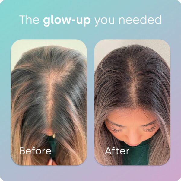 Cápsulas dentro de la caja