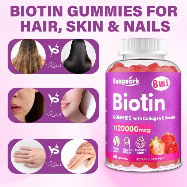 Botella Euapeark biotina gomitas para crecimiento cabello saludable