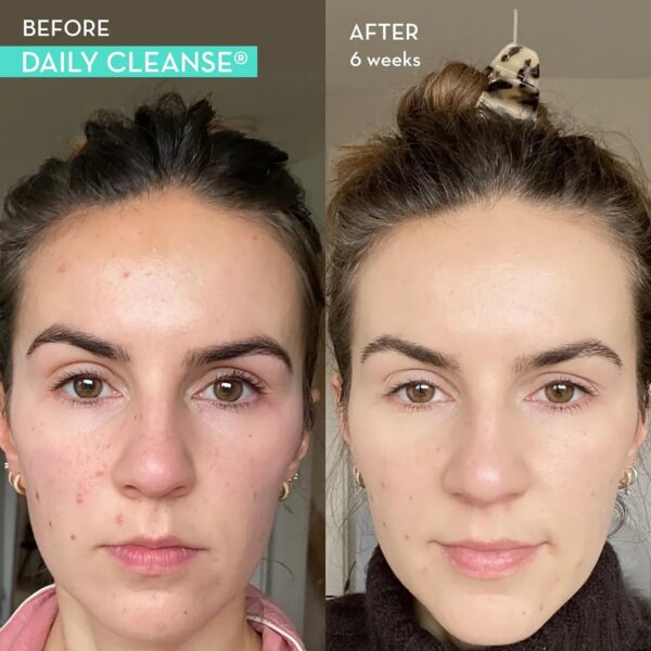 Contenido suplemento HUM detox para piel e hígado natural