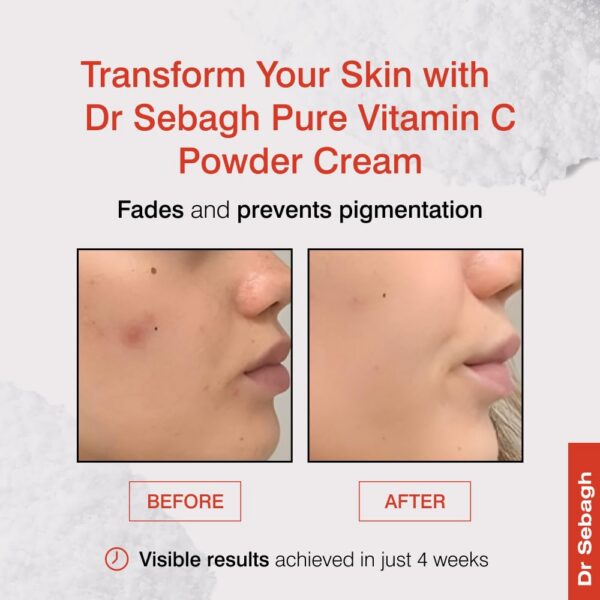 Crema polvo vitamina c rostro Dr Sebagh para piel luminosa