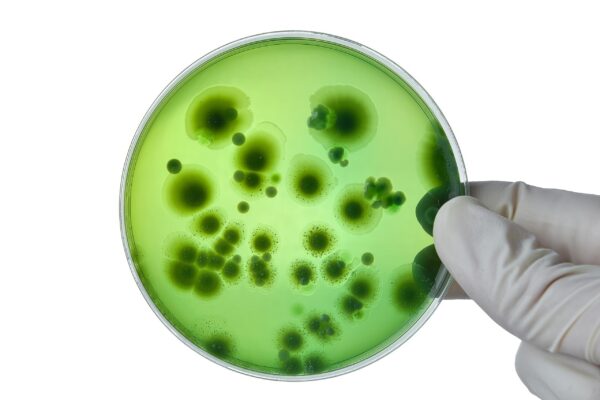 Cultivo de hongos con Agar Extracto de Malta