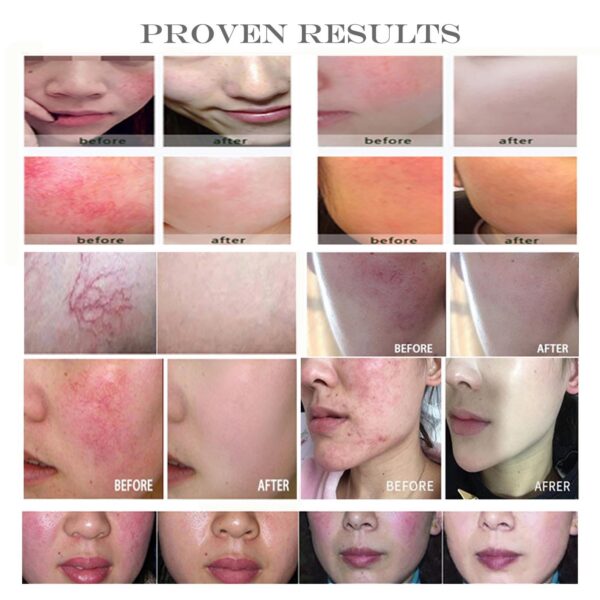 Ingredientes y detalles de producto