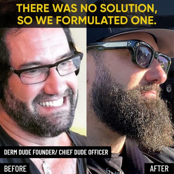 Cuidado diario de barba en envase