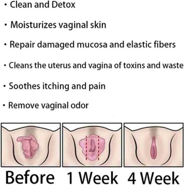 Version 1.0.0 Detox vaginal expresión firmeza y piel rosada saludable