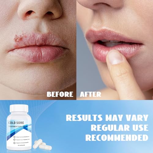 Empaque exterior de LovelyStore