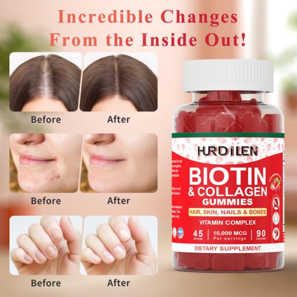 Version 1.0.0 Gomitas Hurdilen en mano