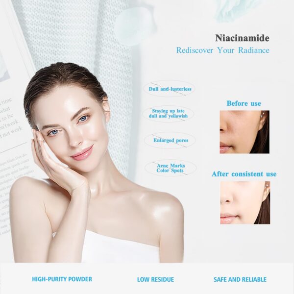 Ingredientes de niacinamida para sueros y tónicos cosméticos