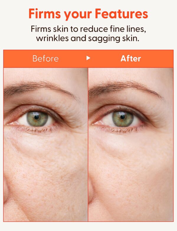 Back view of It's Skin cream packaging