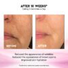 Mejora tono piel y reduce manchas Gomitas Miracle Elixir