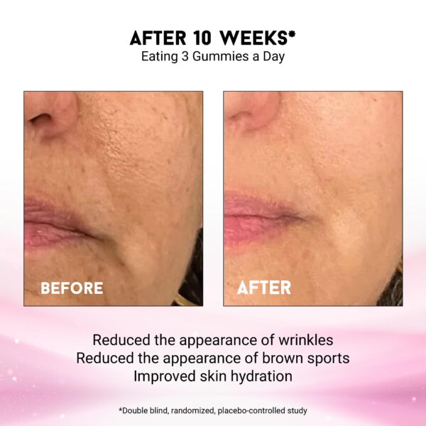 Mejora tono piel y reduce manchas Gomitas Miracle Elixir