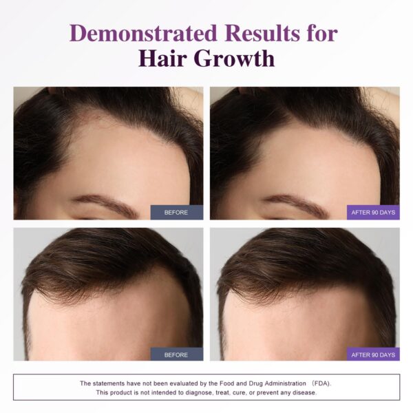 Paquete de 120 cápsulas Biotina Bevalence