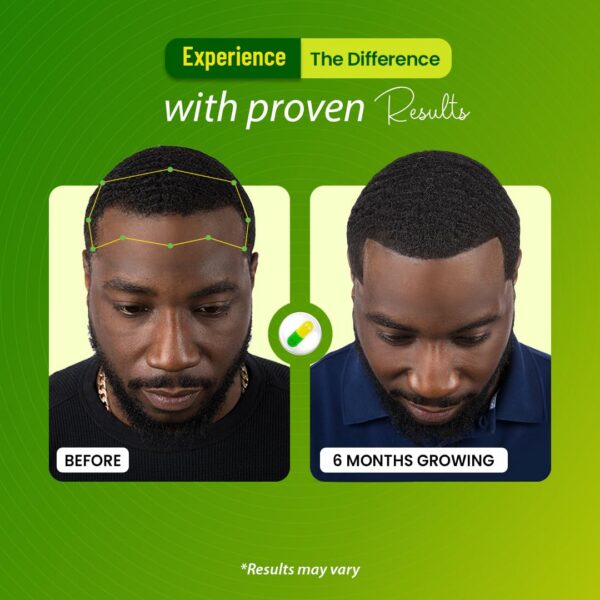 Cápsulas dentro de la caja