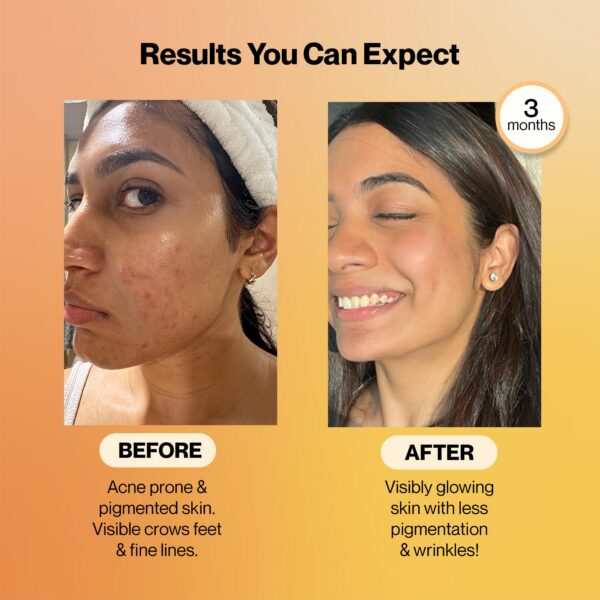 Tabletas efervescentes de Glutathione