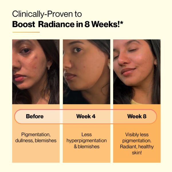 Producto SETU en caja con branding