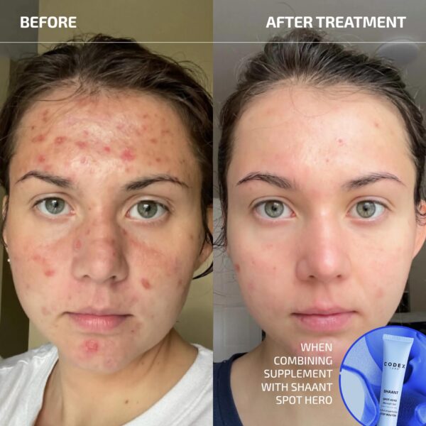 Version 1.0.0 Cápsulas veganas Shaant Clear Skin