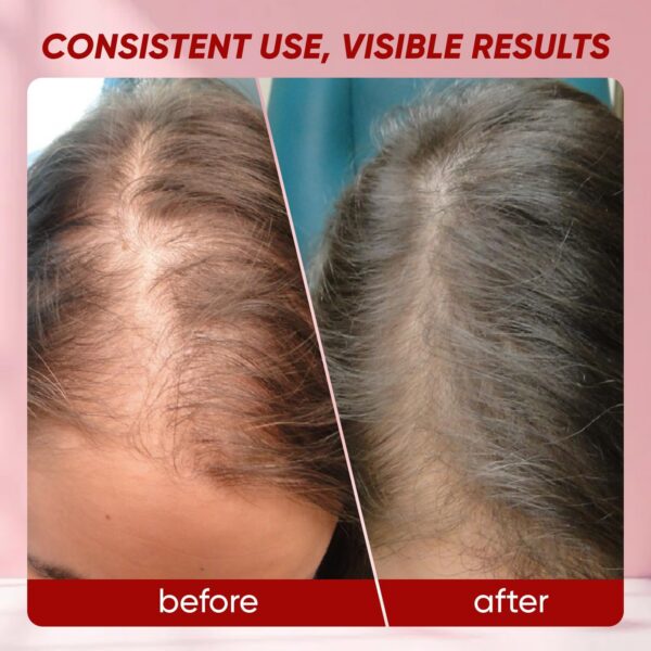 Version 1.0.0 SHWFHI Lumin gomitas cabello palmetto impresos