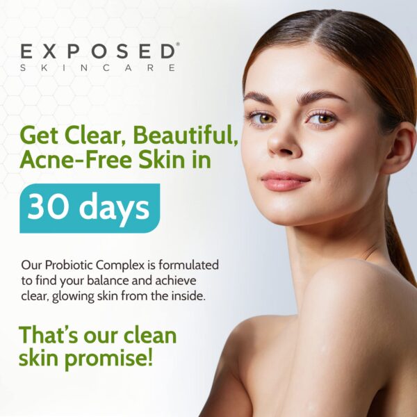 Suplemento para apoyar salud inmune y piel clara Exposed Skin Care