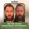 Live Bearded Beard Boost multivitaminas para barba saludable