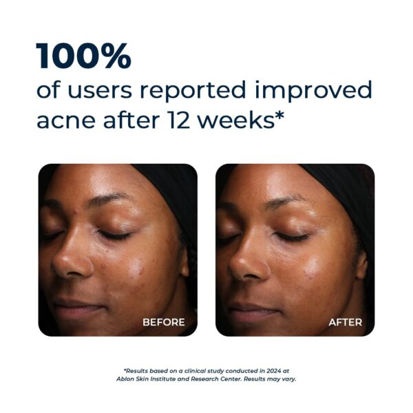 Suplemento natural para aclarar la piel