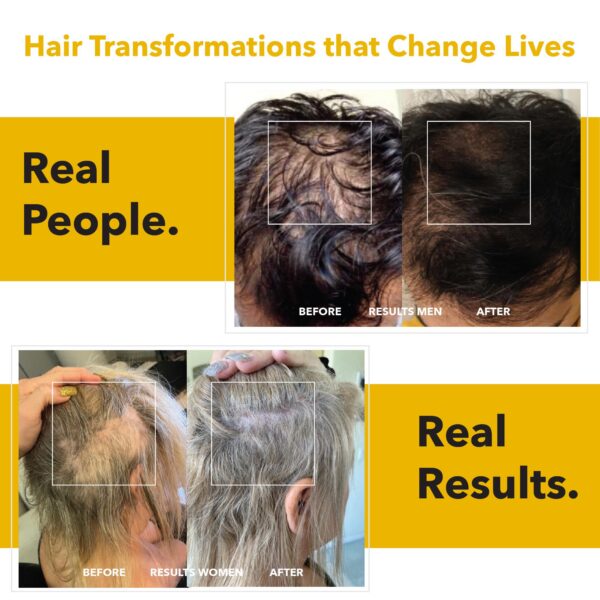 Version 1.0.0 Suplemento natural para cabello saludable y crecimiento