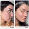 Version 1.0.0 Suplemento vegano Skin Accumax jane iredale