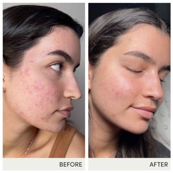 Version 1.0.0 Suplemento vegano Skin Accumax jane iredale