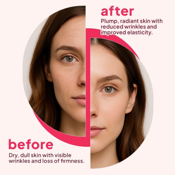 Vista general del producto