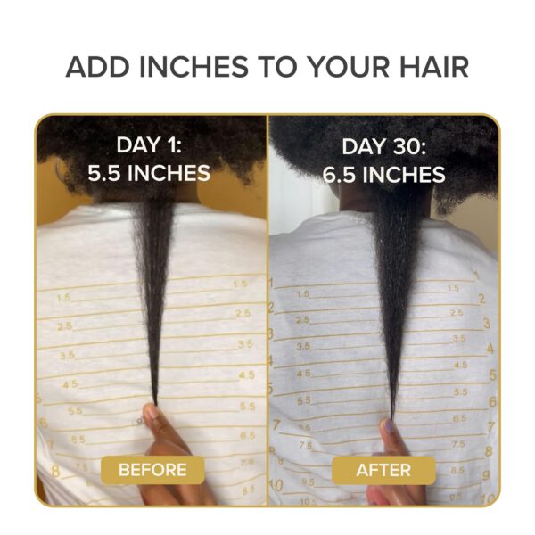 Vitaminas naturales para cabello y uñas Shedavi